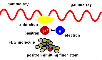 [Scheme of FDG generation of positrons]