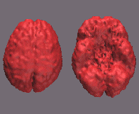 [3D PET images of the brain]