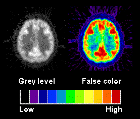 [PET color vs gray level imaging]