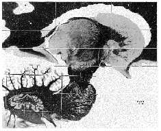Stereotactical Surgery 02: Brain atlas
