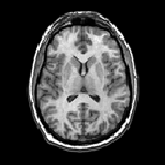 MRI brain section